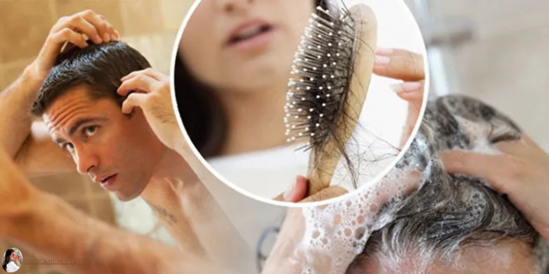 Understanding Hair Care for Thinning Hair